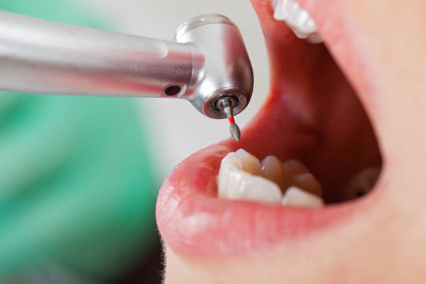 Best Cracked Tooth Emergency Dentist  in Jefferson, GA